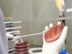 Espanha cria rede para combater a resistência antimicrobiana